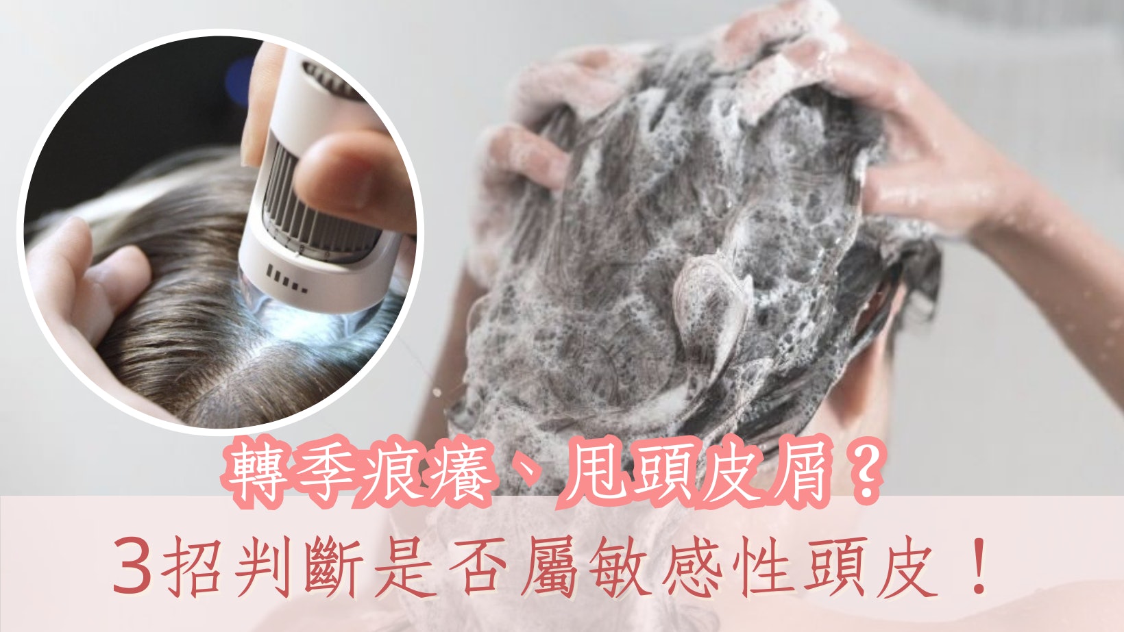 頭皮痕癢就是敏感性頭皮?3大症狀初步判斷及舒緩|換季皮膚問題 頭皮痕癢就是敏感性頭皮?3大症狀初步判斷及舒緩|換季皮膚問題