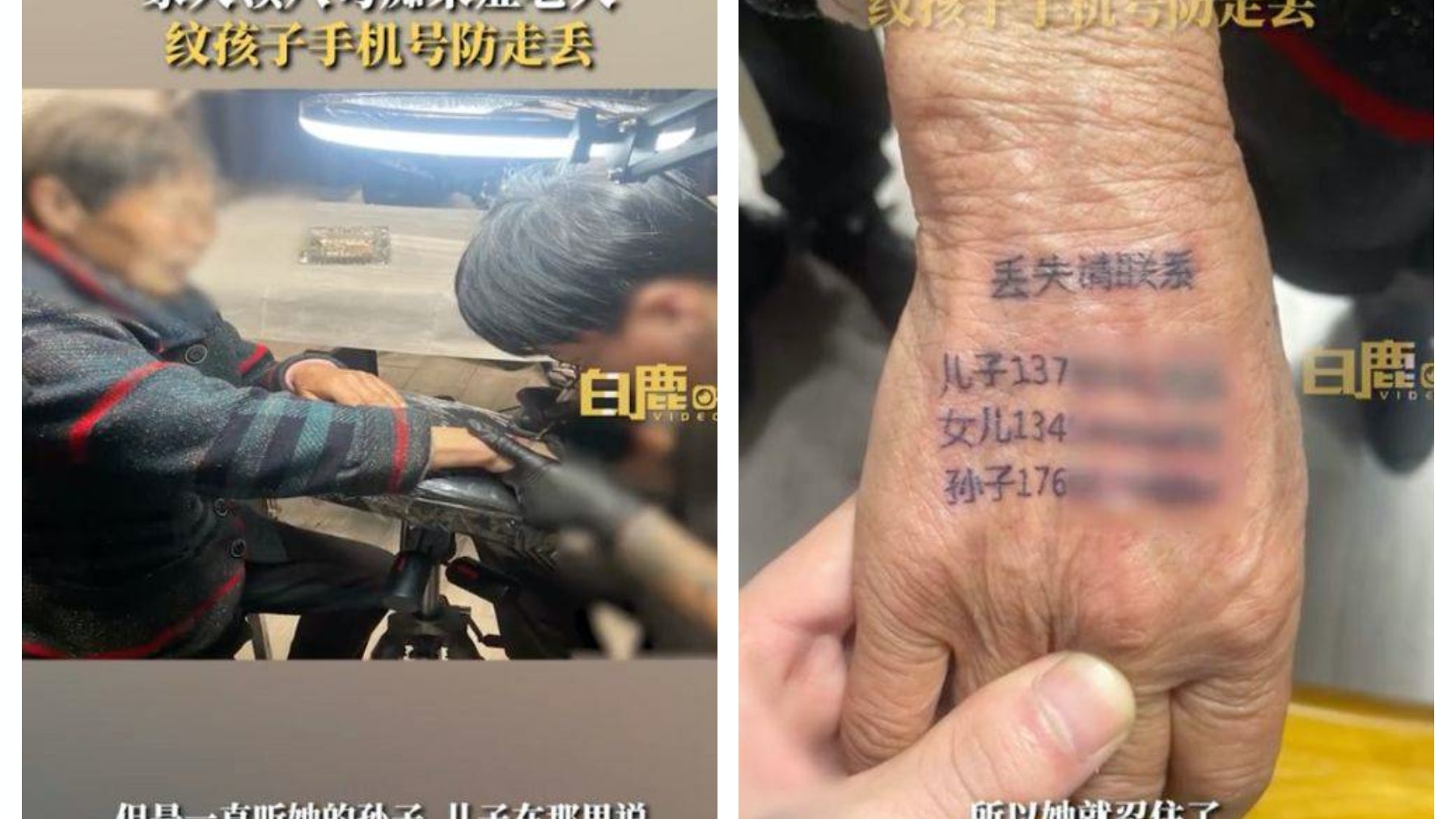 失智症|婆婆患阿茲海默症常走失!家人無奈將聯絡電話紋在她手上 失智症|婆婆患阿茲海默症常走失!家人無奈將聯絡電話紋在她手上