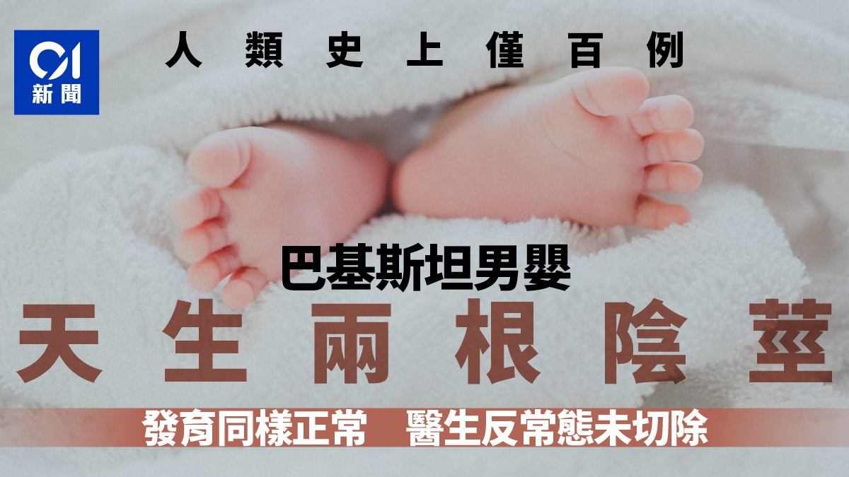 巴基斯坦罕見病嬰天生「2根小弟」 人類史上僅100例 巴基斯坦罕見病嬰天生「2根小弟」 人類史上僅100例