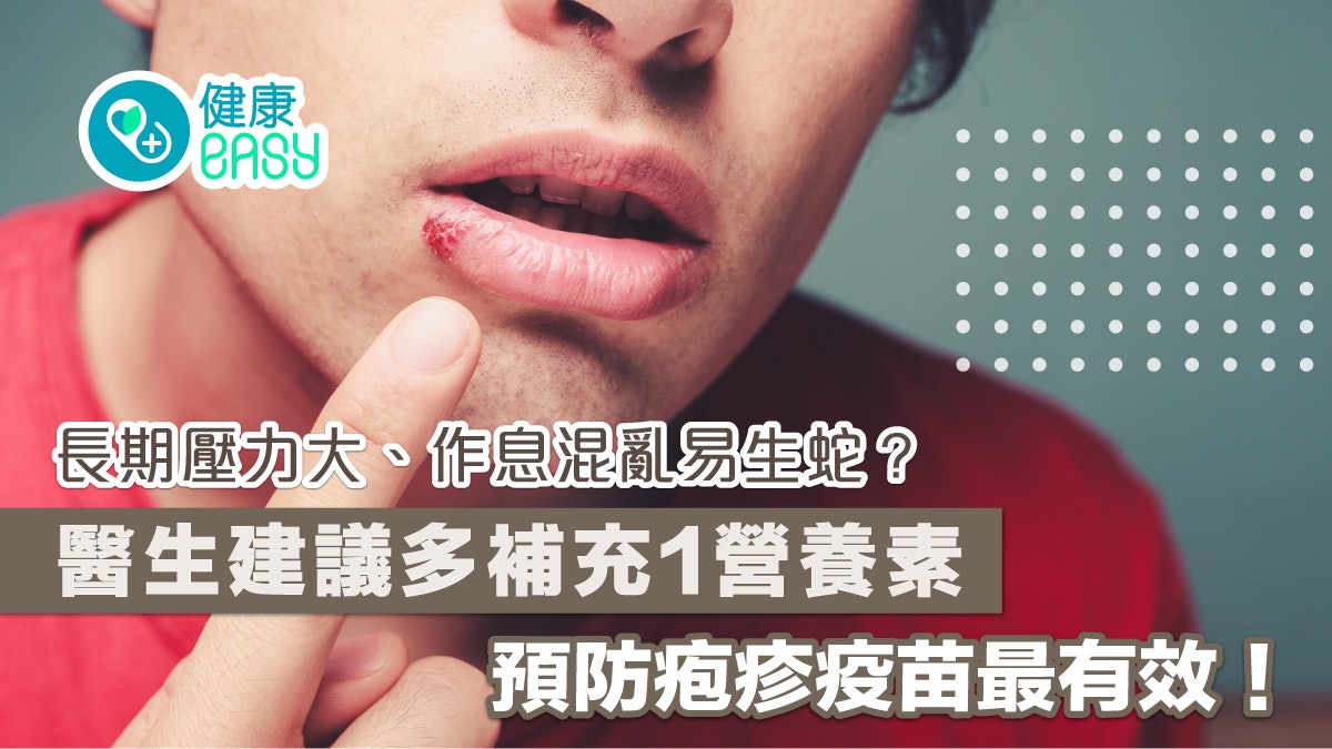 帶狀疱疹|長期壓力大、作息混亂易生蛇 醫生建議多補充1營養素 帶狀疱疹|長期壓力大、作息混亂易生蛇 醫生建議多補充1營養素