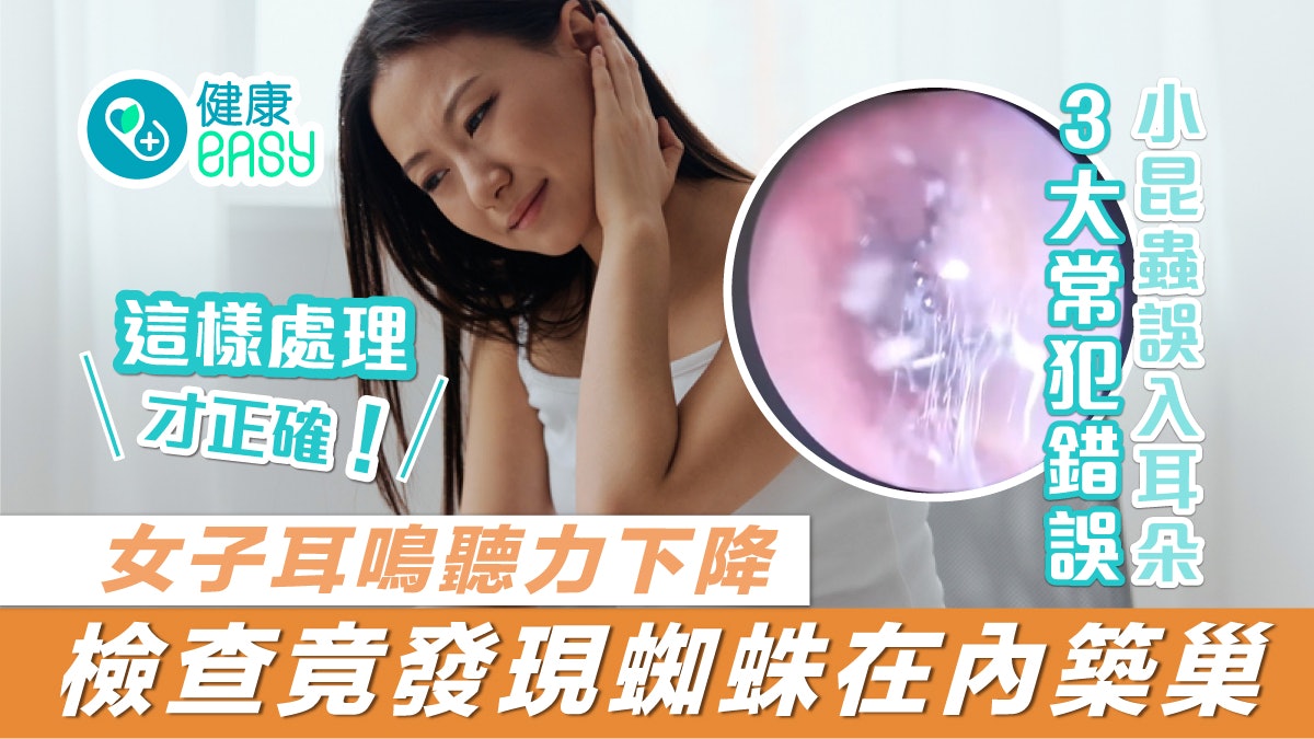 異物進耳|女子耳鳴聽力下降 檢查竟發現蜘蛛在內築巢! 異物進耳|女子耳鳴聽力下降 檢查竟發現蜘蛛在內築巢!