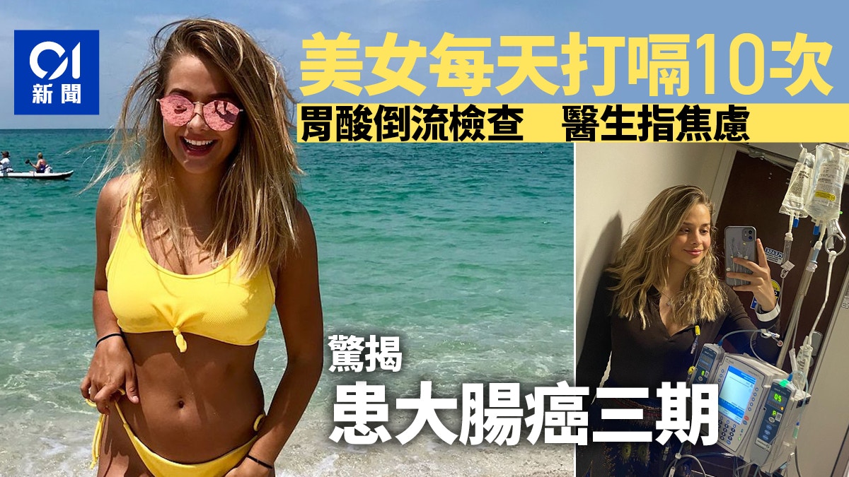 陽光美女每天打嗝10次　原以為是焦慮　再檢查驚悉已大腸癌三期