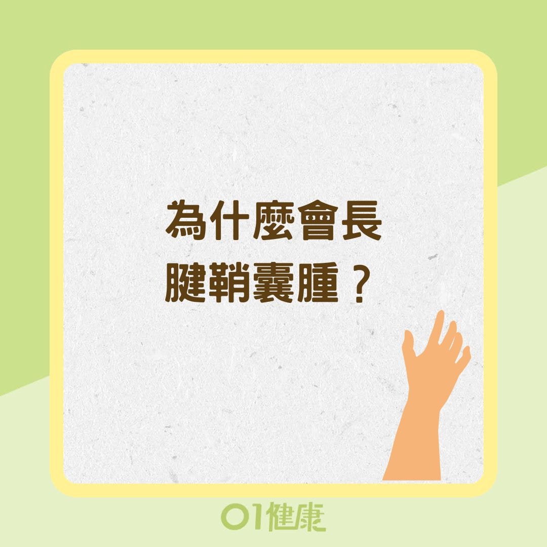 為什麼會長腱鞘囊腫？（01製圖）