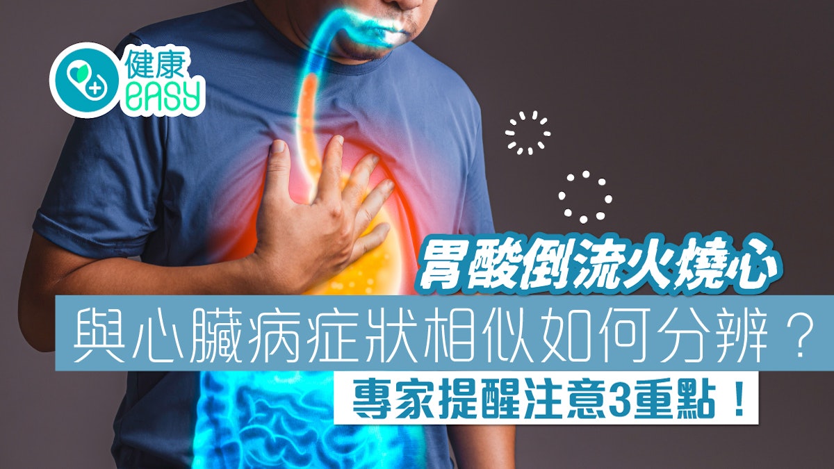 心臟病|如何區分胃酸倒流火燒心與心臟病?專家教3重點提高警覺 心臟病|如何區分胃酸倒流火燒心與心臟病?專家教3重點提高警覺