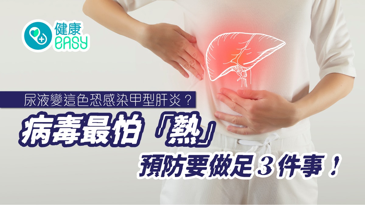 肝臟健康|尿液變這色小心感染甲型肝炎!預防3重點病毒最怕1件事 肝臟健康|尿液變這色小心感染甲型肝炎!預防3重點病毒最怕1件事