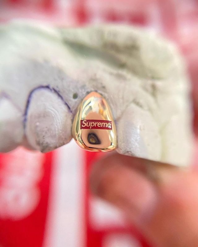 1 of 1 Supreme Box Logo gold tooth made by Tetsuya Akiyama