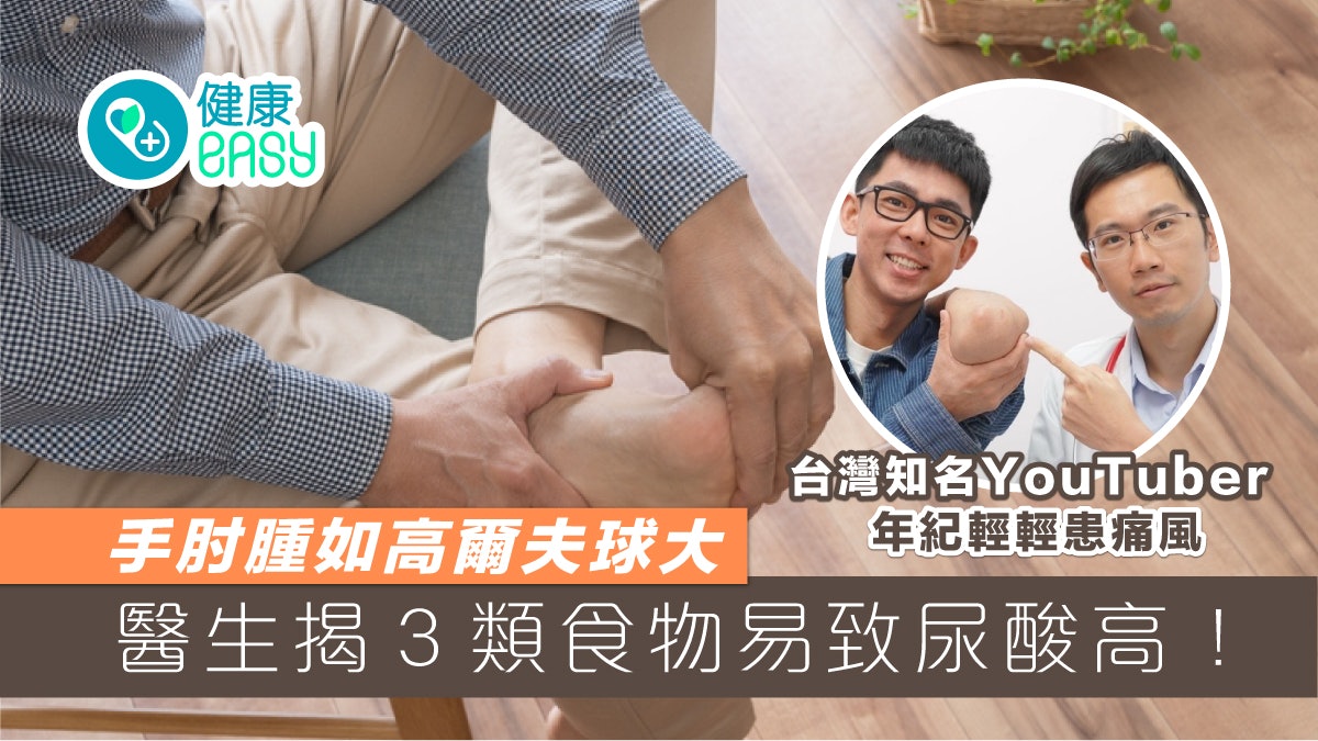 痛風|手肘腫如高爾夫球全因痛風惹禍!3類食物致尿酸高要避免 痛風|手肘腫如高爾夫球全因痛風惹禍!3類食物致尿酸高要避免