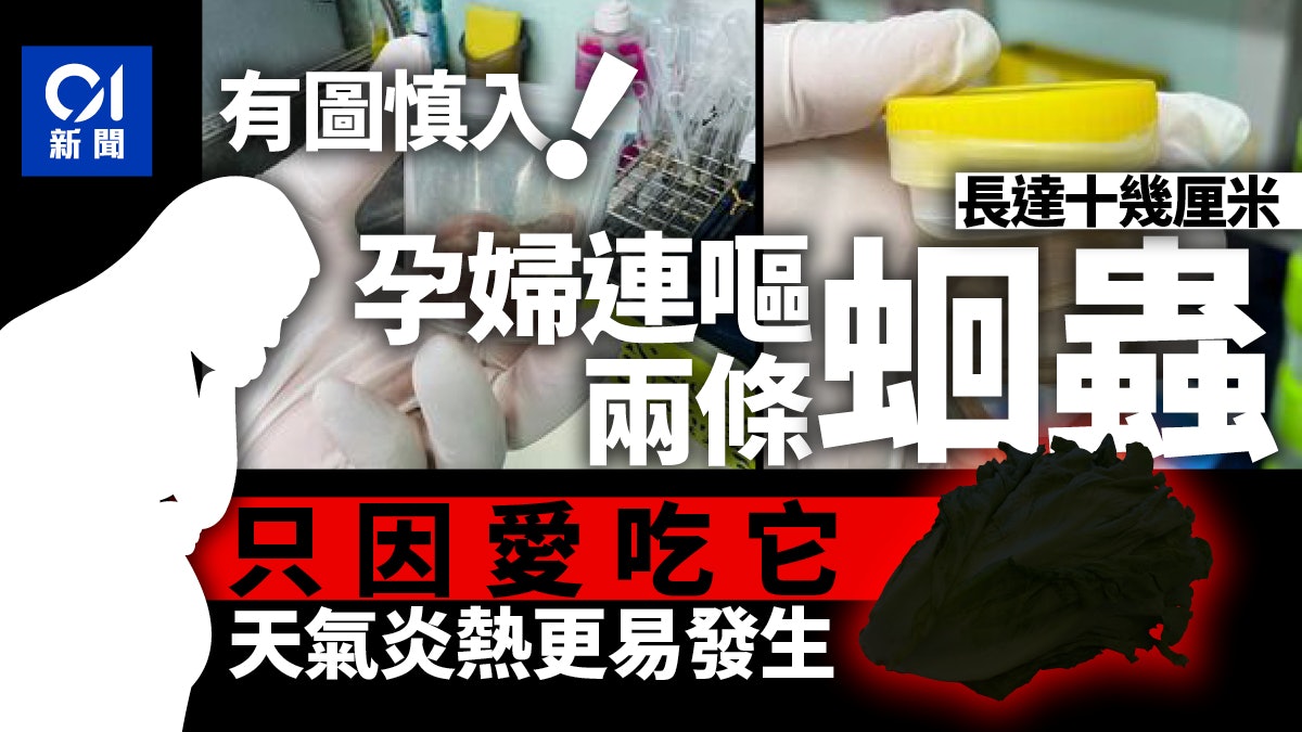 泰國孕婦嘔吐物驚見2條「超長蛔蟲」 只因愛吃它|有圖慎入 泰國孕婦嘔吐物驚見2條「超長蛔蟲」 只因愛吃它|有圖慎入