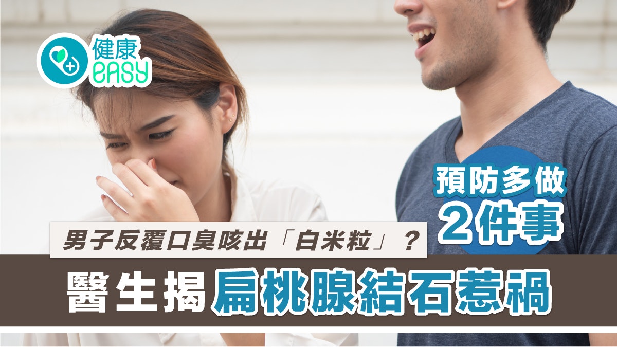 男子反覆口臭咳出「白米粒」?醫揭扁桃腺結石惹禍 多做2步預防 男子反覆口臭咳出「白米粒」?醫揭扁桃腺結石惹禍 多做2步預防