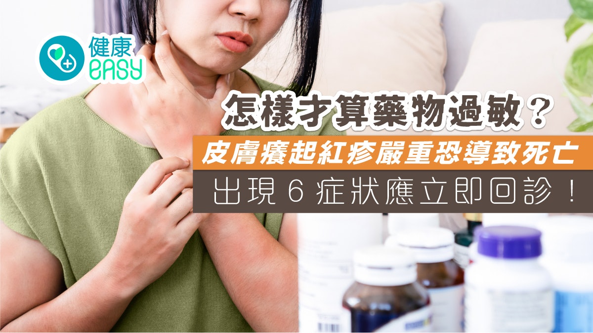 藥物過敏|皮膚癢起紅疹嚴重恐導致死亡 有6初期症狀立即回診 藥物過敏|皮膚癢起紅疹嚴重恐導致死亡 有6初期症狀立即回診