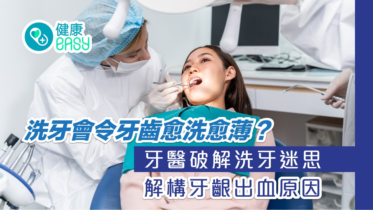 牙齒健康|洗牙會把牙齒洗壞?牙醫破解迷思、牙齦出血原因 牙齒健康|洗牙會把牙齒洗壞?牙醫破解迷思、牙齦出血原因
