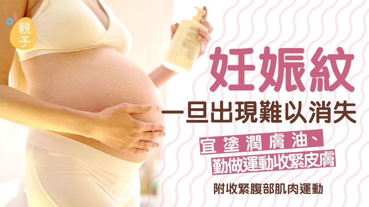 妊娠紋|妊娠紋一旦出現難以消失 宜塗潤膚油、勤做運動收緊皮膚 妊娠紋|妊娠紋一旦出現難以消失 宜塗潤膚油、勤做運動收緊皮膚