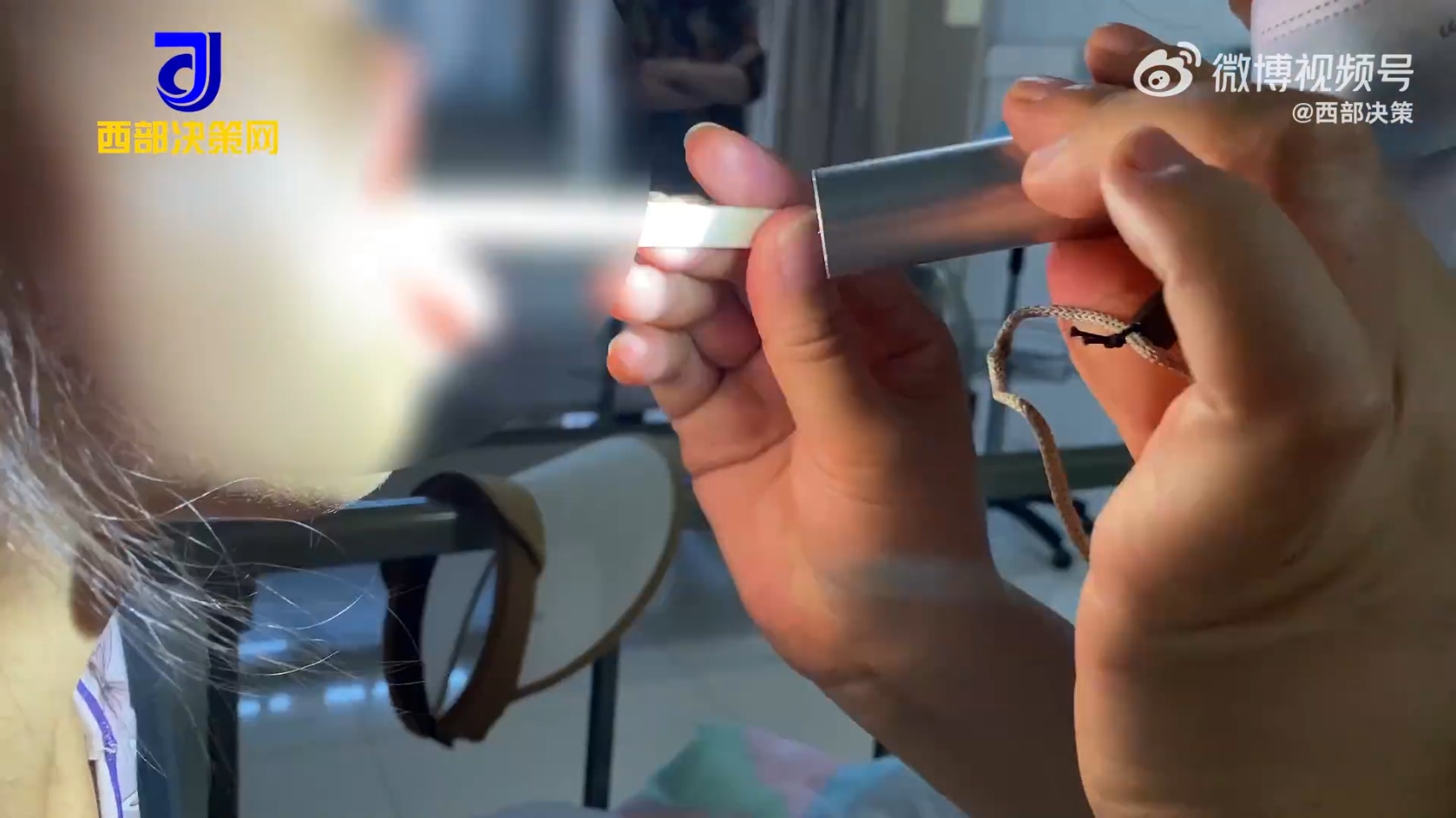 9歲女童被貓抓傷後確診這病高燒14天不退伴有頭痛乏力精神差