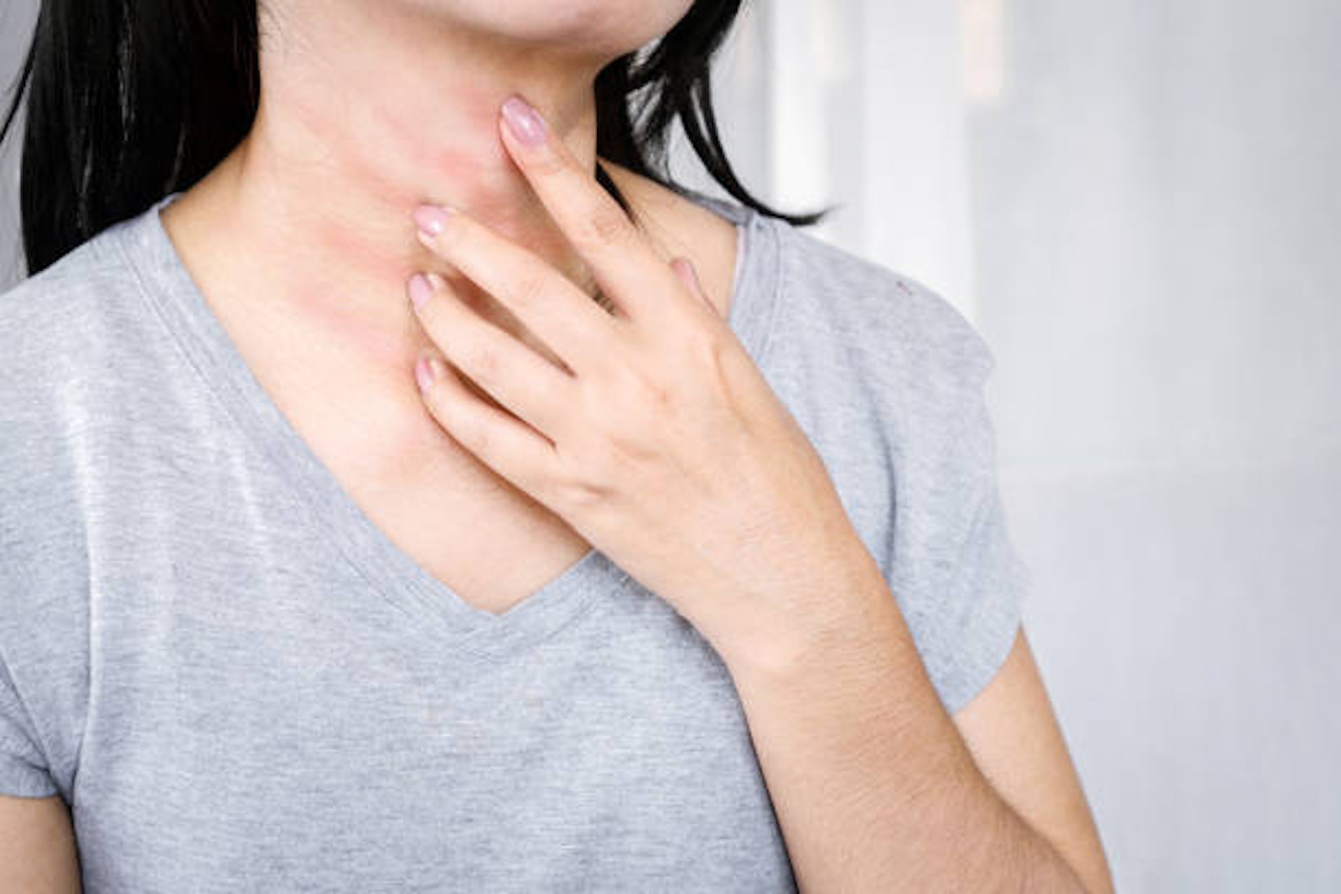 口腔過敏綜合症的過敏症狀一般圍繞在嘴唇、口腔、喉嚨範圍(iStock) 口腔過敏綜合症的過敏症狀一般圍繞在嘴唇、口腔、喉嚨範圍(iStock)