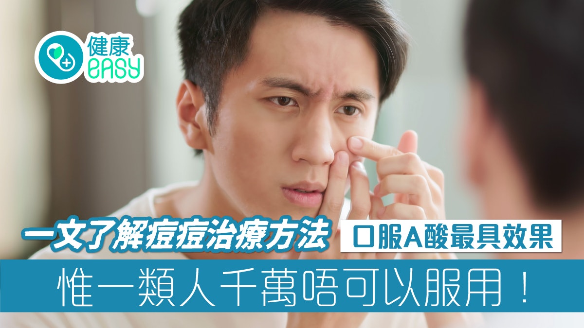 暗瘡|飽受青春痘困擾點算好?3種方法治療嚴重痘痘這種最有效 暗瘡|飽受青春痘困擾點算好?3種方法治療嚴重痘痘這種最有效