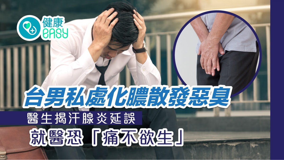 台男私密處化膿散發陣陣惡臭 醫揭汗腺炎延誤就醫恐「痛不欲生」 台男私密處化膿散發陣陣惡臭 醫揭汗腺炎延誤就醫恐「痛不欲生」