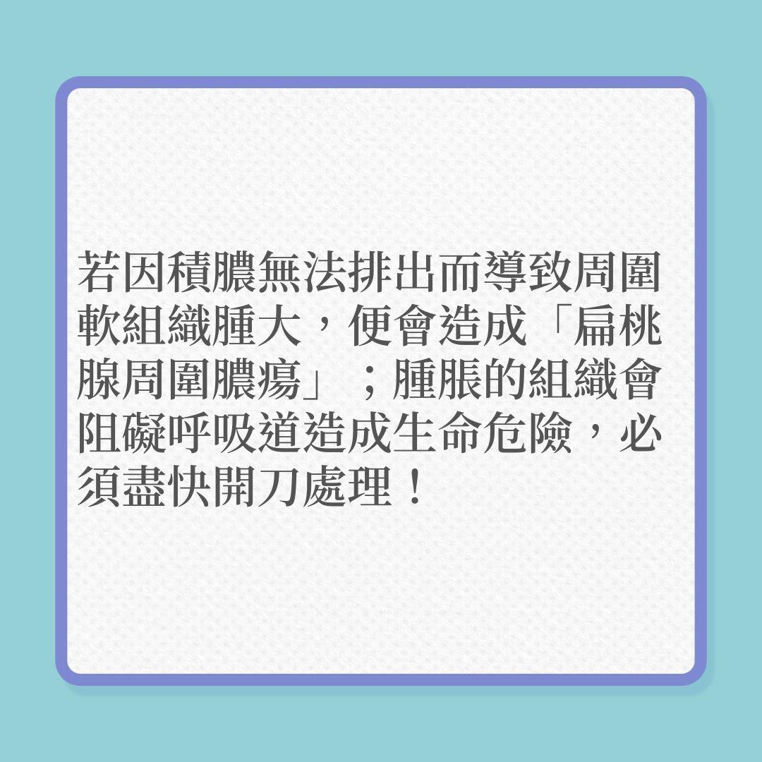 喉嚨痛嚴重可致命，6個情況，別當普通感冒！（01製圖）