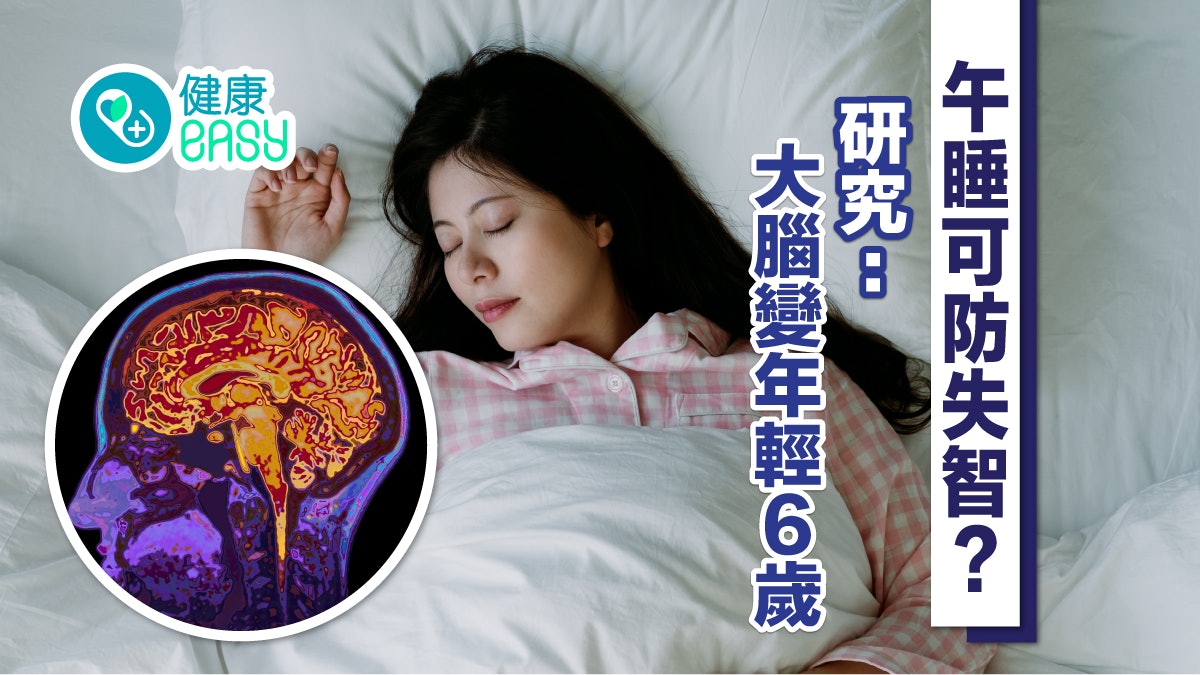 失智症|研究揭午睡助防範大腦萎縮 有效增加腦容量提高學習力 失智症|研究揭午睡助防範大腦萎縮 有效增加腦容量提高學習力