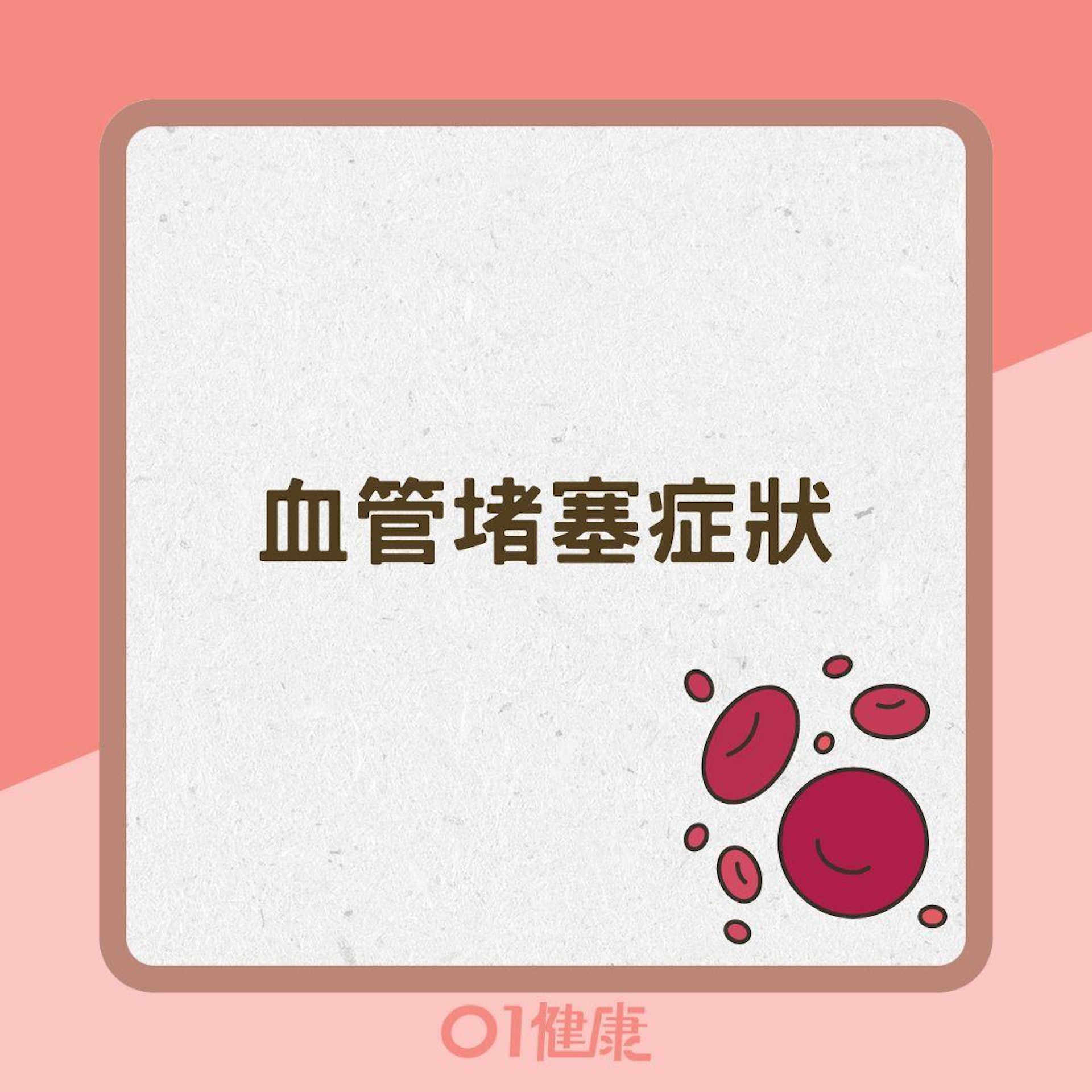 血管堵塞症狀(01製圖) 血管堵塞症狀(01製圖)
