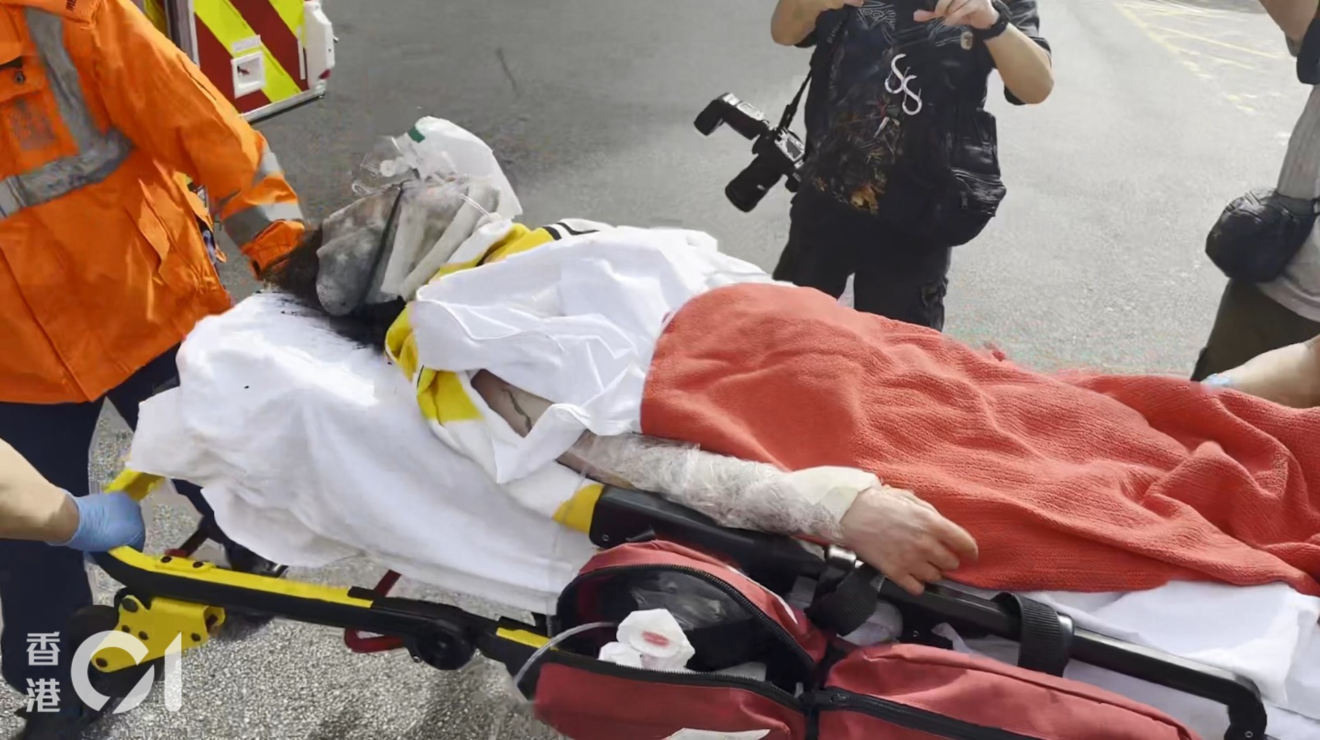 其中一名女傷者被送到醫院時戴上氧氣罩協助呼吸,她頭髮燒焦,臉部及手部亦燒傷,需以敷料保護。(王譯揚攝) 其中一名女傷者被送到醫院時戴上氧氣罩協助呼吸,她頭髮燒焦,臉部及手部亦燒傷,需以敷料保護。(王譯揚攝)