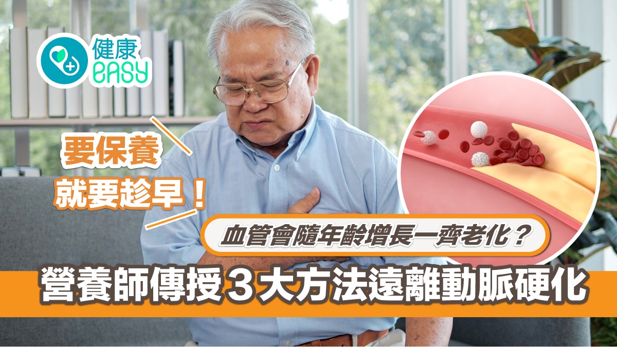 心血管健康|年紀大血管老化毛病多?3方法保養血管遠離動脈硬化 心血管健康|年紀大血管老化毛病多?3方法保養血管遠離動脈硬化