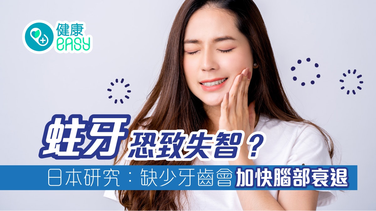 牙齒健康|蛀牙恐致失智?日本研究:缺少牙齒會加快腦部衰退 牙齒健康|蛀牙恐致失智?日本研究:缺少牙齒會加快腦部衰退