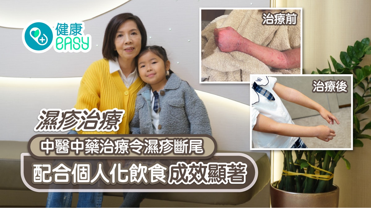 濕疹治療丨中醫中藥治療令濕疹斷尾 配合個人化飲食成效顯著 濕疹治療丨中醫中藥治療令濕疹斷尾 配合個人化飲食成效顯著