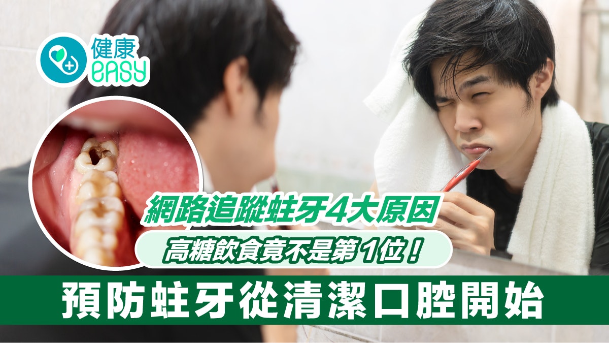 牙齒健康|蛀牙4大原因高糖飲食最有害?預防蛀牙從這一步做起 牙齒健康|蛀牙4大原因高糖飲食最有害?預防蛀牙從這一步做起
