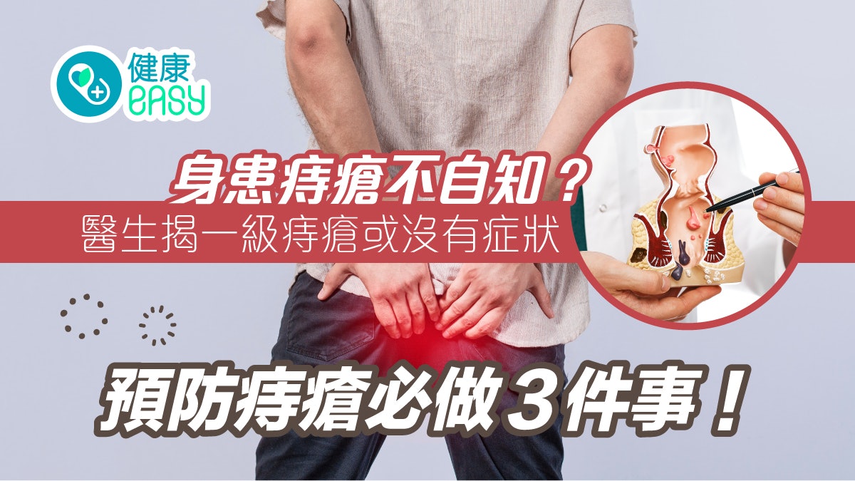 痔瘡|便秘容易長痔瘡?高纖飲食、規律運動3招可預防避免做一事 痔瘡|便秘容易長痔瘡?高纖飲食、規律運動3招可預防避免做一事