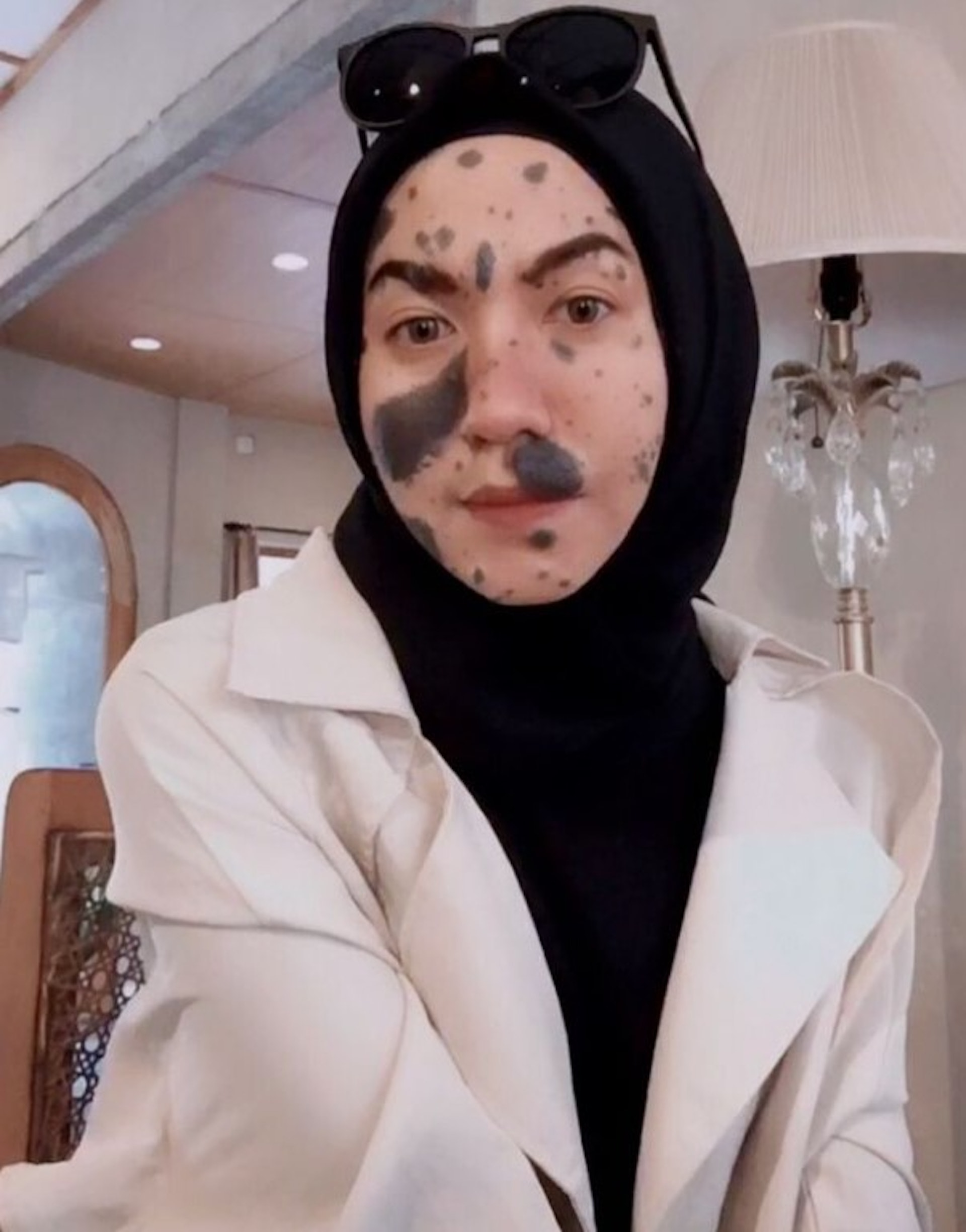 馬來西亞有女生因臉上長有黑色胎記,幸運遇到位不介意她外貌的男友,卻因對方家人擔憂胎記會遺傳,令她與男友被迫分手。(IG@sabrinafellani) 馬來西亞有女生因臉上長有黑色胎記,幸運遇到位不介意她外貌的男友,卻因對方家人擔憂胎記會遺傳,令她與男友被迫分手。(IG@sabrinafellani)