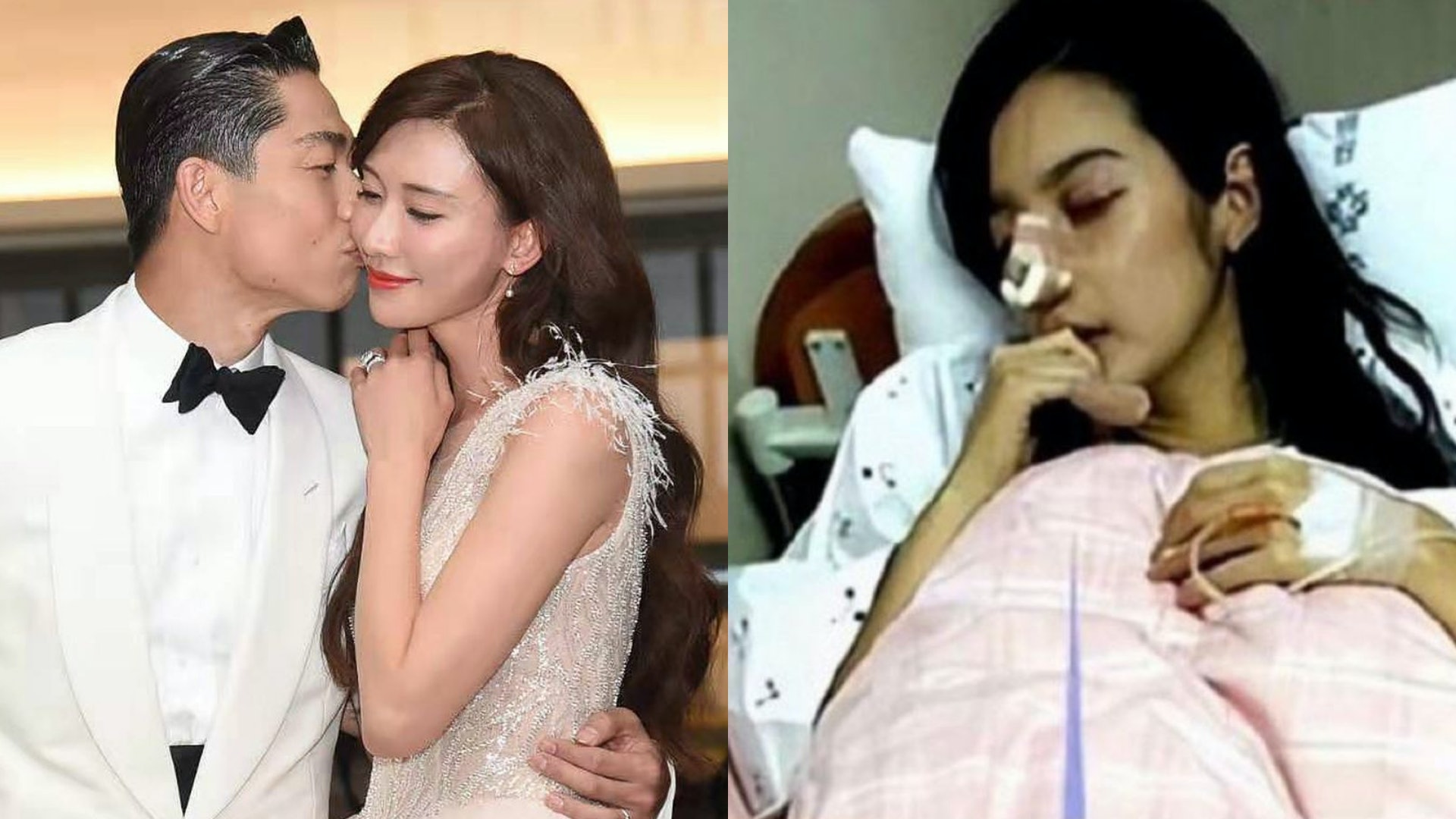 林志玲疑遭AKIRA家暴「打爆鼻」入院照片陸網瘋傳高EQ回應