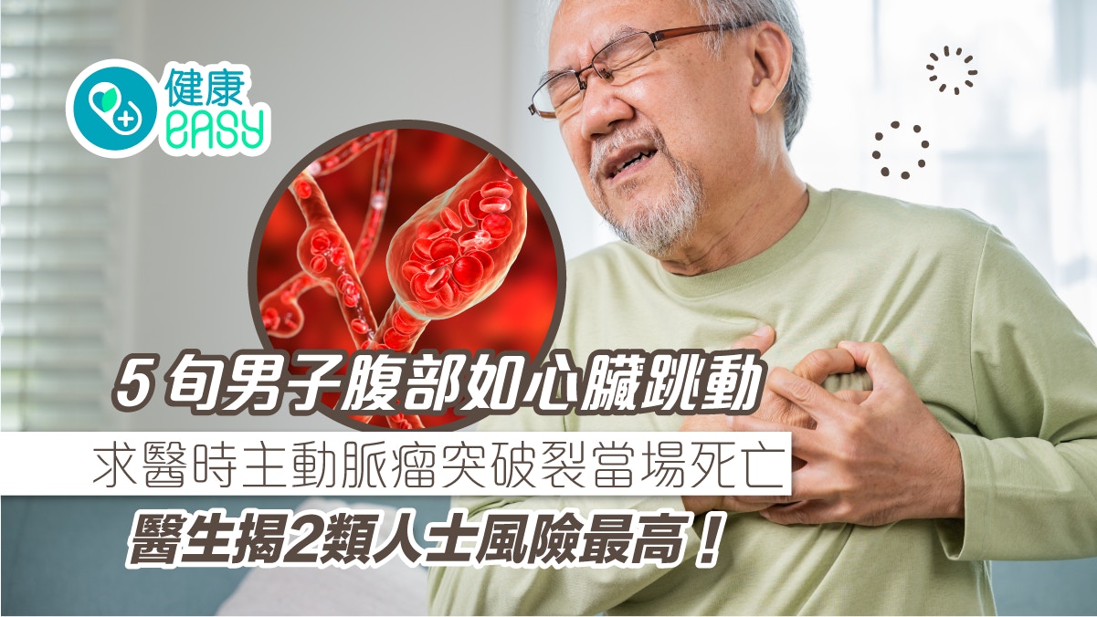 主動脈瘤｜５旬男子腹部如心臟跳動 求醫才知身患９厘米動脈瘤