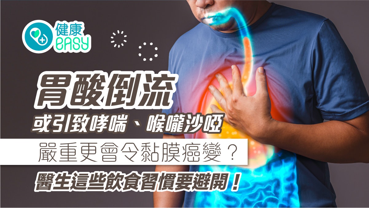 胃酸倒流|喉嚨沙啞、咳嗽屬非典型症狀?醫生勸避開地雷飲食習慣 胃酸倒流|喉嚨沙啞、咳嗽屬非典型症狀?醫生勸避開地雷飲食習慣