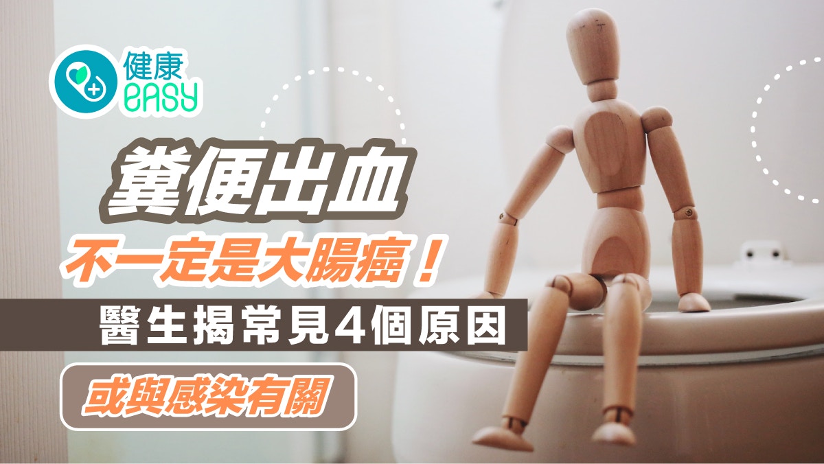 血便｜糞便出血不一定是大腸癌！醫生揭常見4個原因或與感染有關