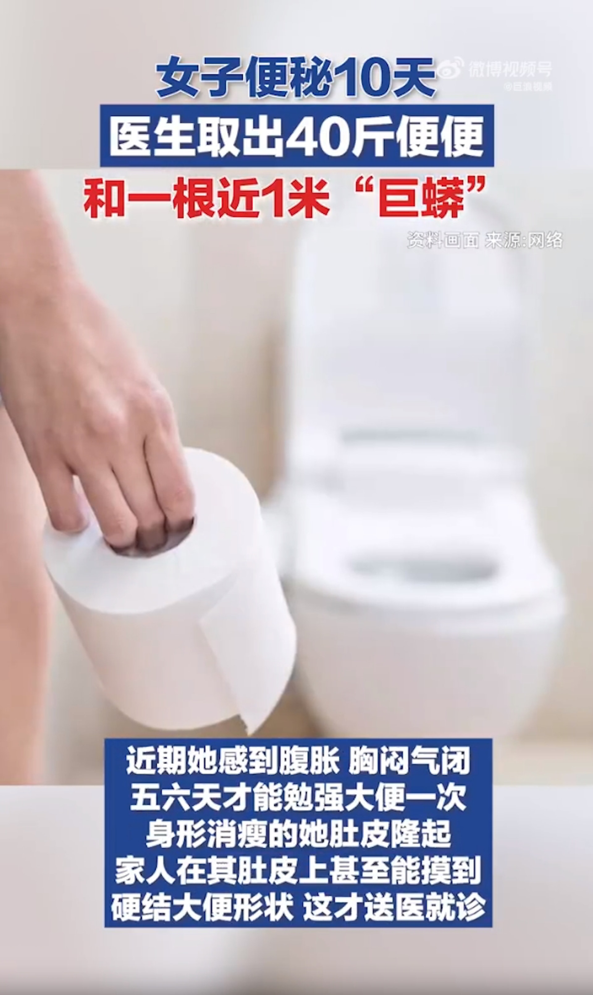 女子便秘十多天 手術取出1米長糞便(微博@巨浪視頻) 女子便秘十多天 手術取出1米長糞便(微博@巨浪視頻)