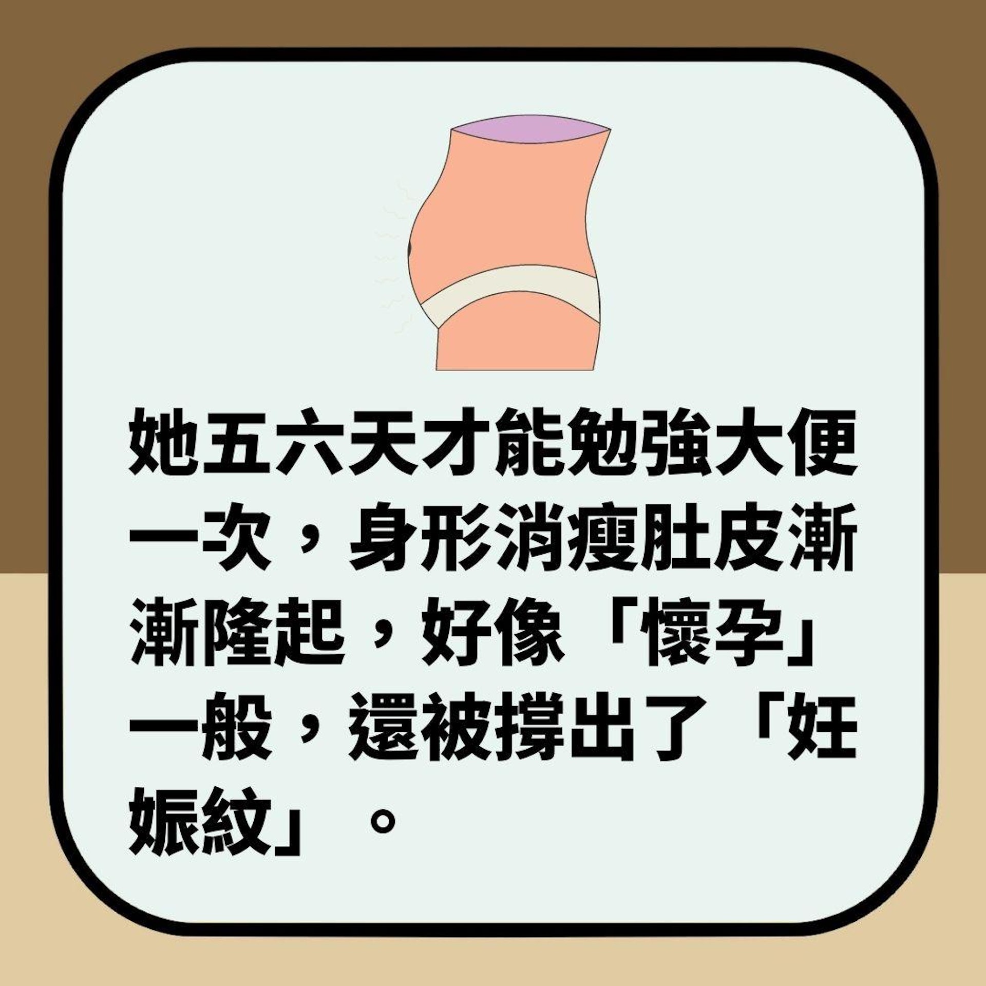女子便秘十多天 手術取出1米長糞便(01製圖) 女子便秘十多天 手術取出1米長糞便(01製圖)