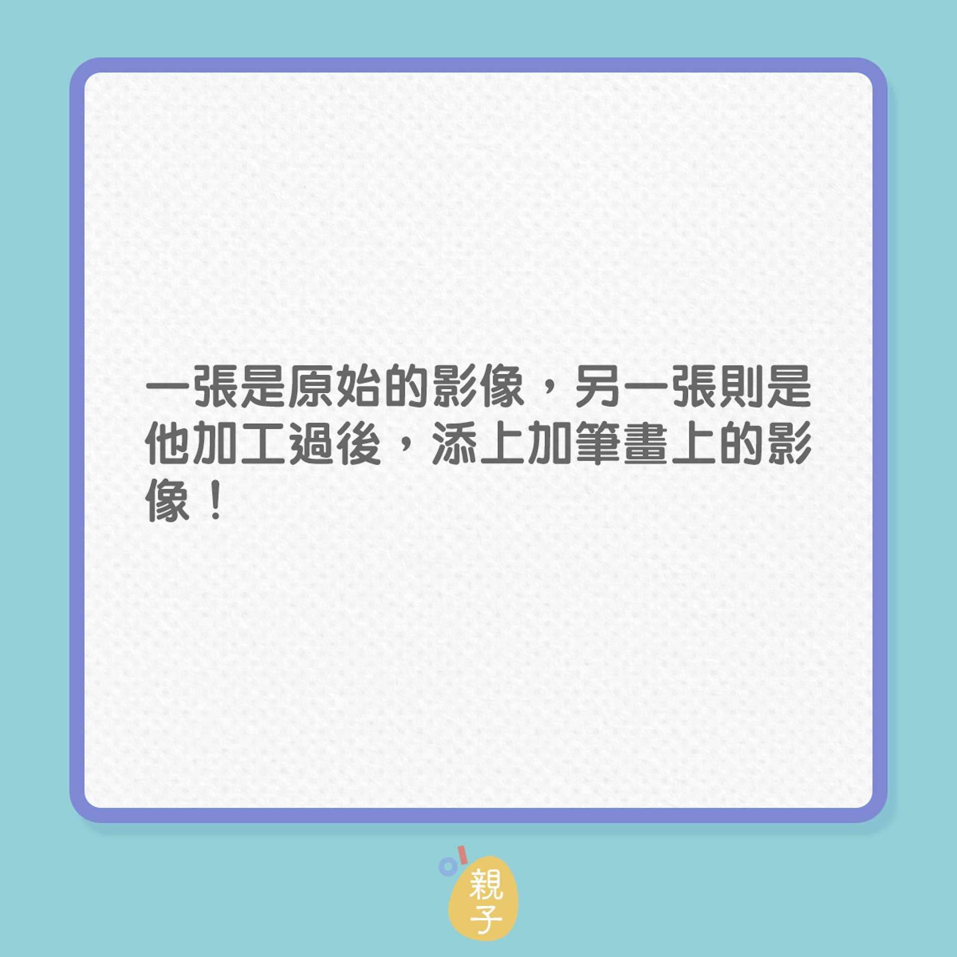 這醫生花點創意,讓一眾準爸媽看懂產檢超聲波照片!(01製圖) 這醫生花點創意,讓一眾準爸媽看懂產檢超聲波照片!(01製圖)