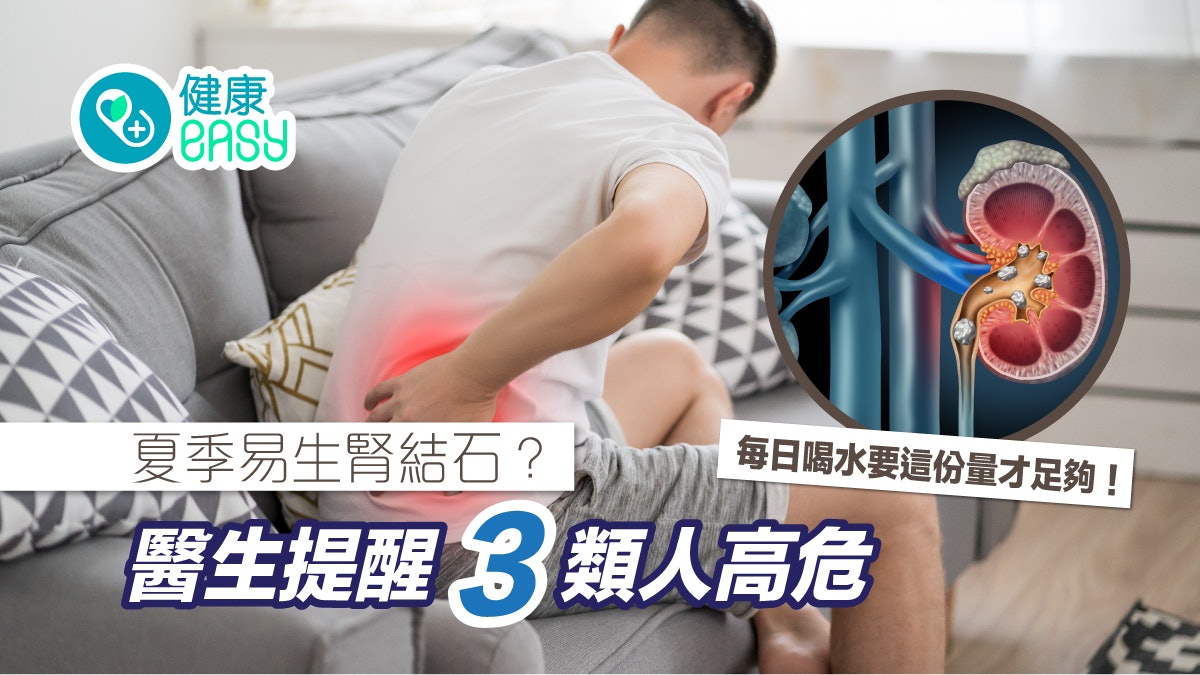 腎結石|40歲台男經常腰痛排尿困難 流汗量多喝水量少增患病風險 腎結石|40歲台男經常腰痛排尿困難 流汗量多喝水量少增患病風險
