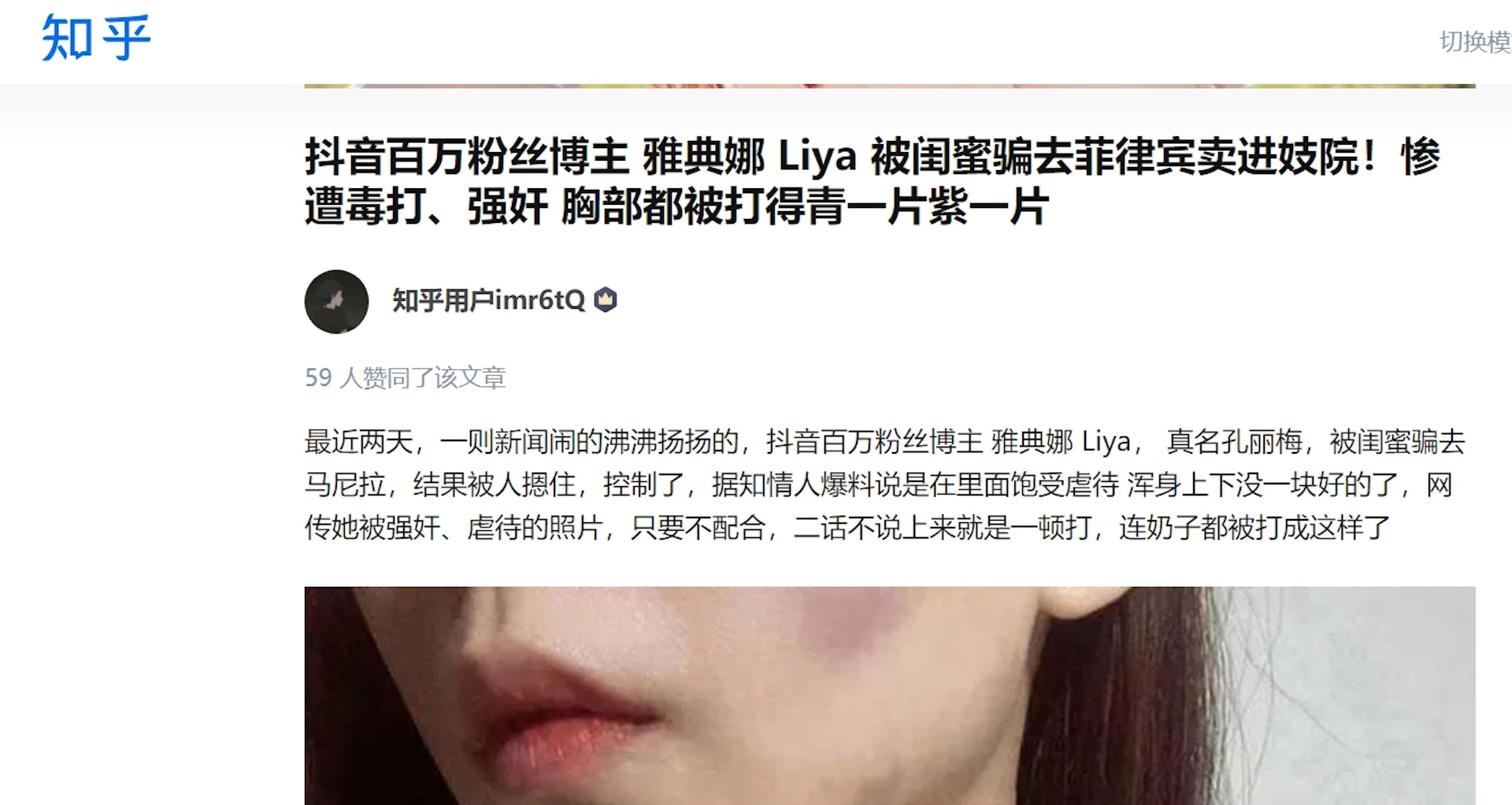 網上熱傳雅典娜遭強姦及賣至菲律賓妓院的消息。(知乎網)