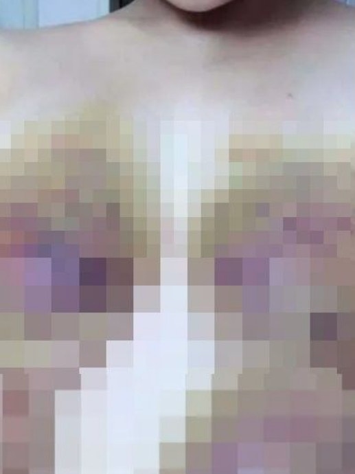 網傳雅典娜疑似挨打的照片。（圖／翻攝自微博）