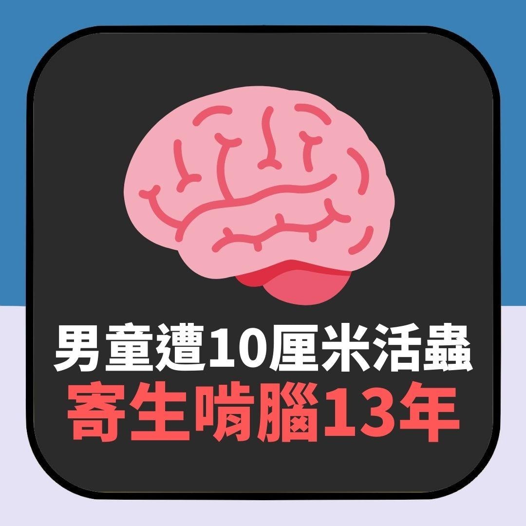 【延伸閱讀】男童遭10厘米活蟲「寄生啃腦」13年致殘　這3種日常壞習慣快改掉（01製圖）