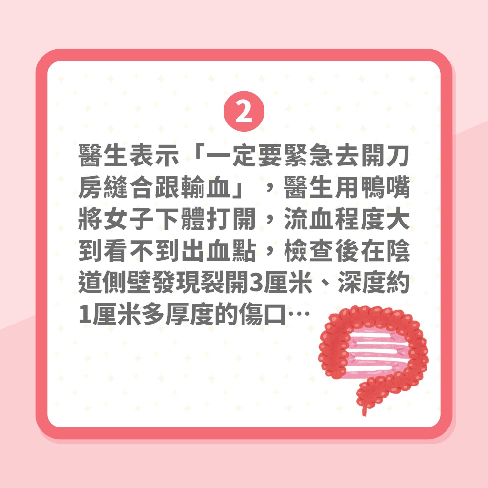 中年女子偷情太激烈「私處血流不止」急入院　醫生：腸子恐掉出來（01製圖）