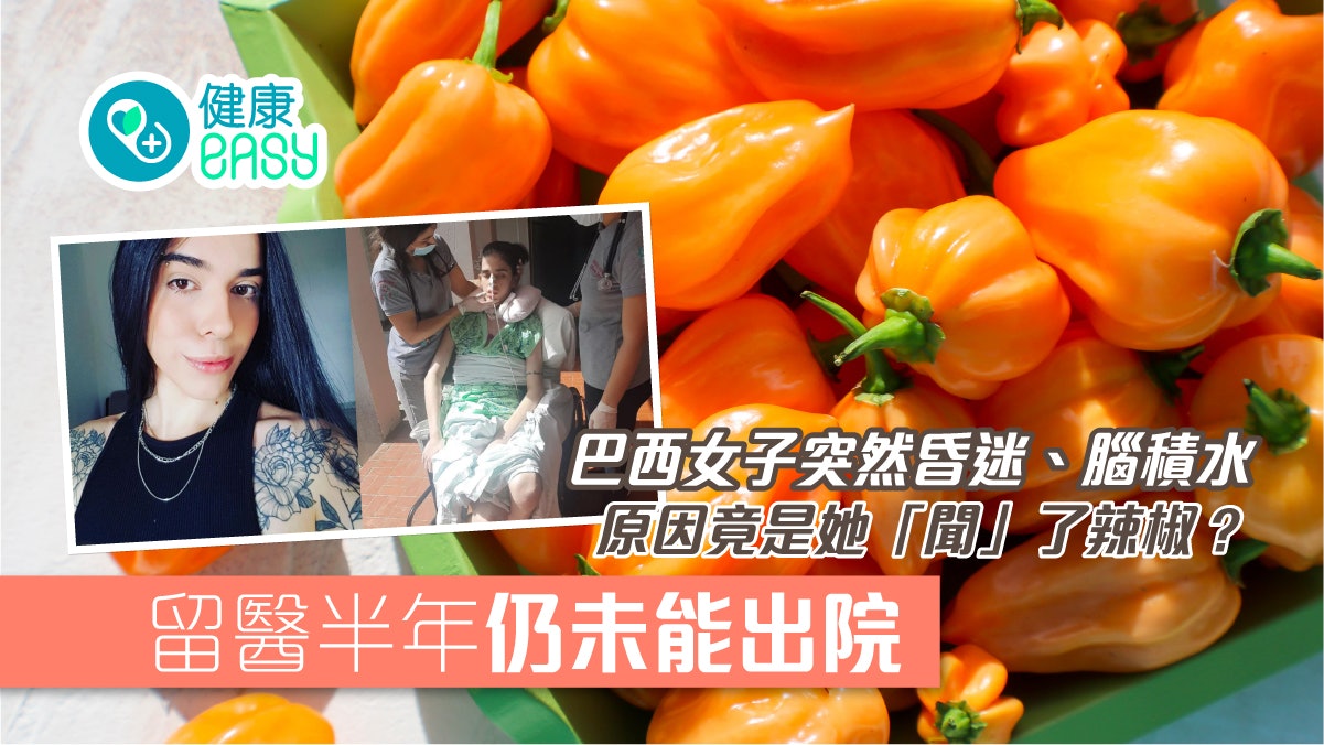 辣椒過敏|巴西女子突然昏迷住院半年仍未康復 只因她聞了辣椒 辣椒過敏|巴西女子突然昏迷住院半年仍未康復 只因她聞了辣椒