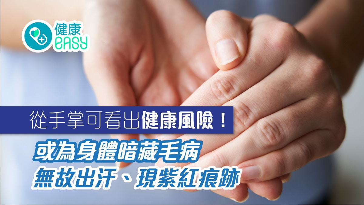 從手掌可看出健康風險！無故出汗、現紫紅痕跡或為身體暗藏毛病