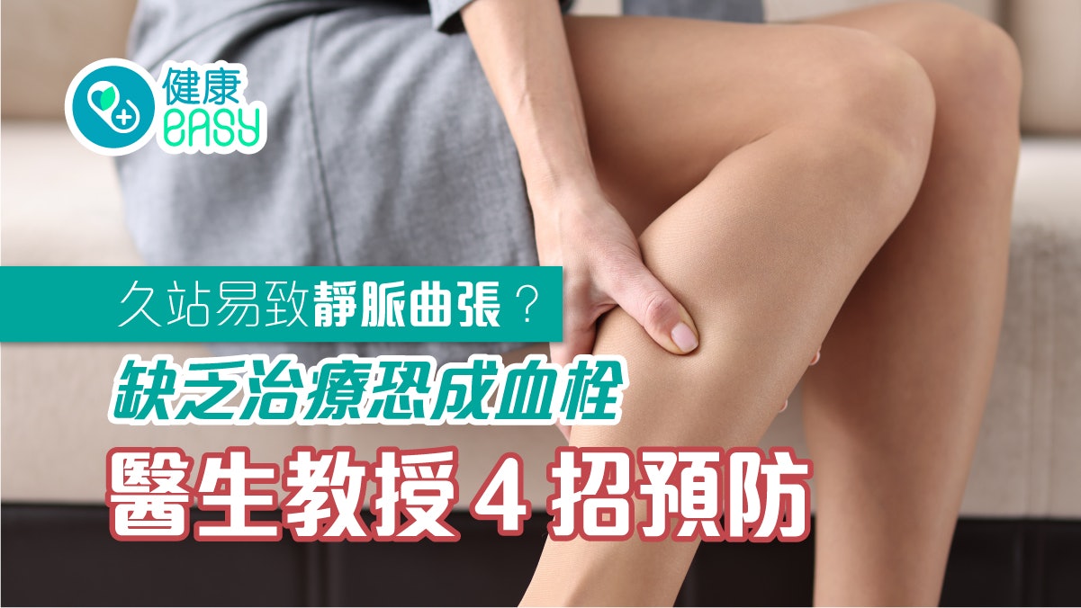 靜脈曲張影響健康?不治療會怎樣?嚴重恐致血栓4招治療這樣預防 靜脈曲張影響健康?不治療會怎樣?嚴重恐致血栓4招治療這樣預防