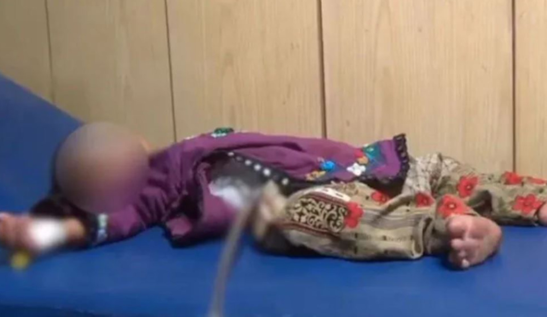 女嬰出生後一直肚痛不適,後來照出胃部有腫瘤,割除後進行化驗,發現是死胎。 (網上圖片) 女嬰出生後一直肚痛不適,後來照出胃部有腫瘤,割除後進行化驗,發現是死胎。 (網上圖片)