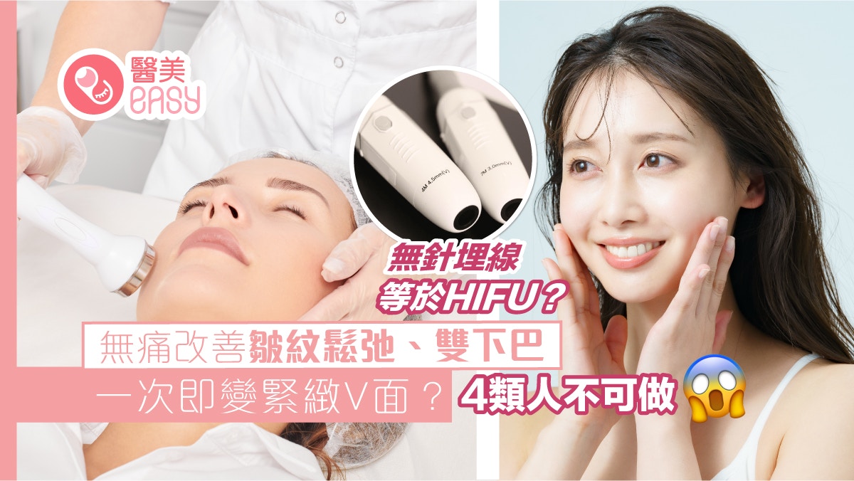 瘦面｜無針埋線等於Hifu？副作用少痛感低改善皺紋鬆弛、雙下巴