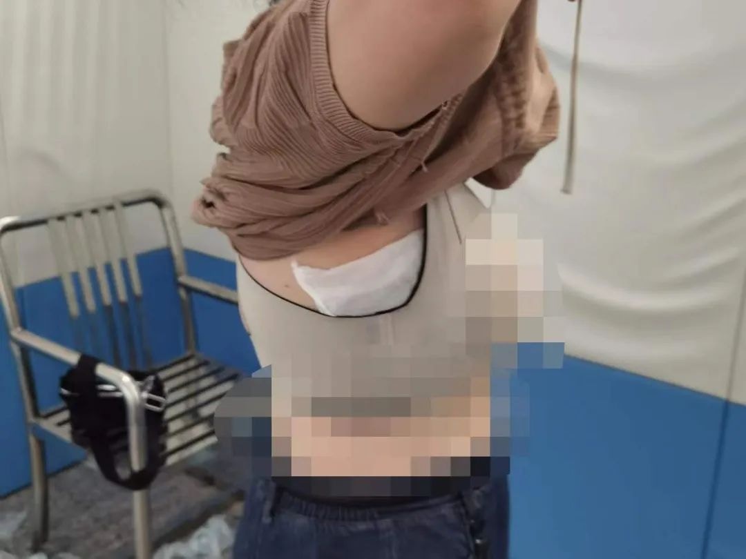一名女子經福田口岸過關時，將16隻蜥蜴藏匿在胸部，最終被深圳海關截查。（海關發布）