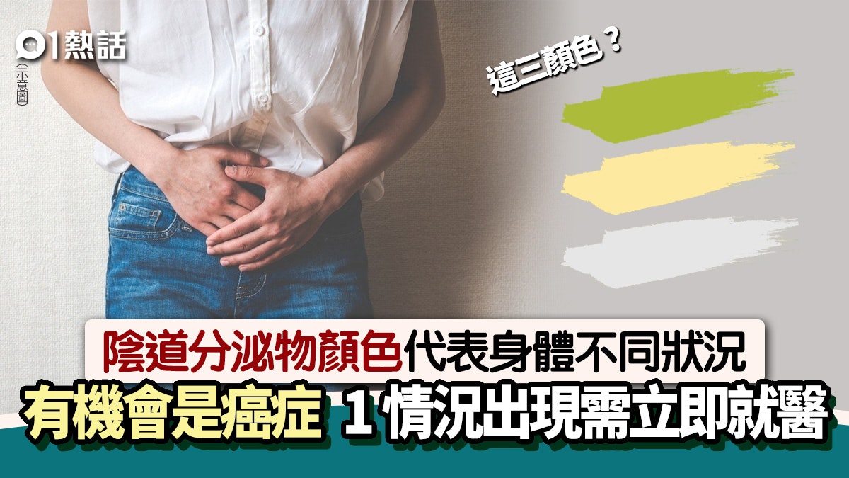 陰道分泌物反映身體狀況 台女醫生教3招辨認 1個情況屬罹癌徵兆 陰道分泌物反映身體狀況 台女醫生教3招辨認 1個情況屬罹癌徵兆