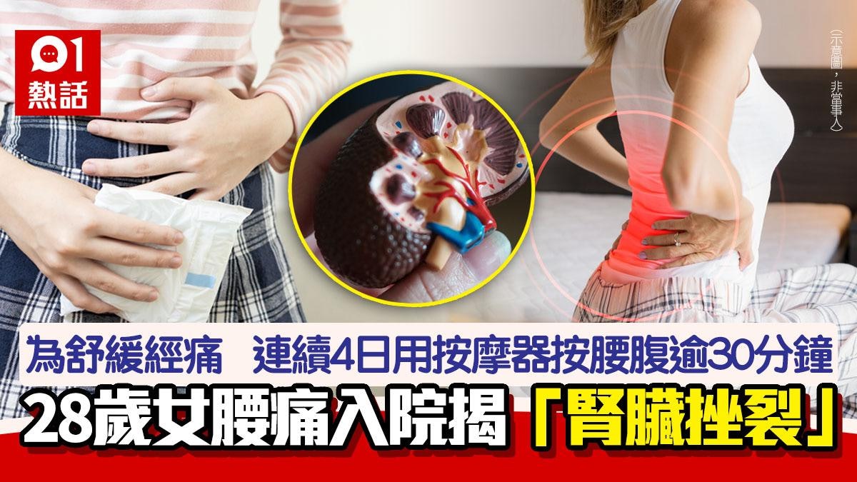 28歲女為減經痛 連續4日用按摩器按腰腹 腰痛求醫竟揭腎臟挫裂 28歲女為減經痛 連續4日用按摩器按腰腹 腰痛求醫竟揭腎臟挫裂